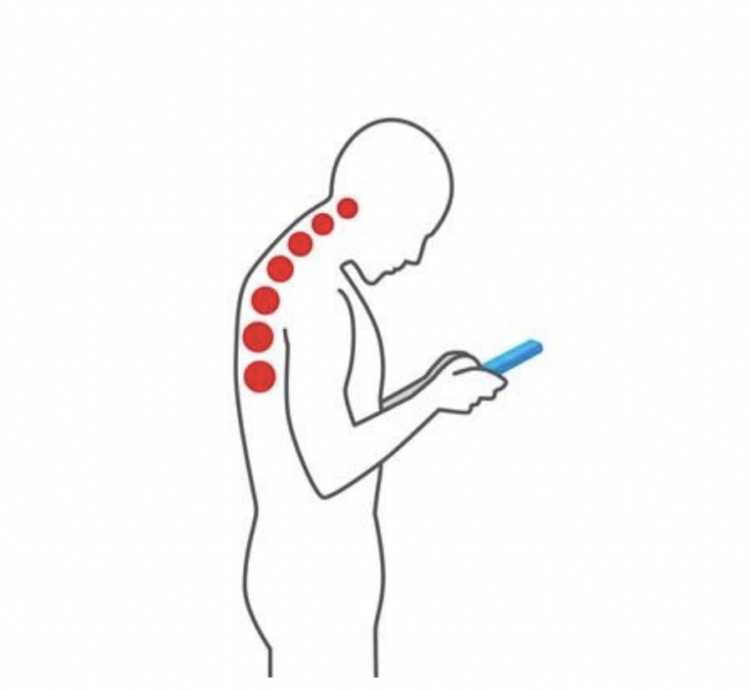8 Main causes of bad posture and tips to correct them