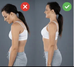 Kyphosis Posture.