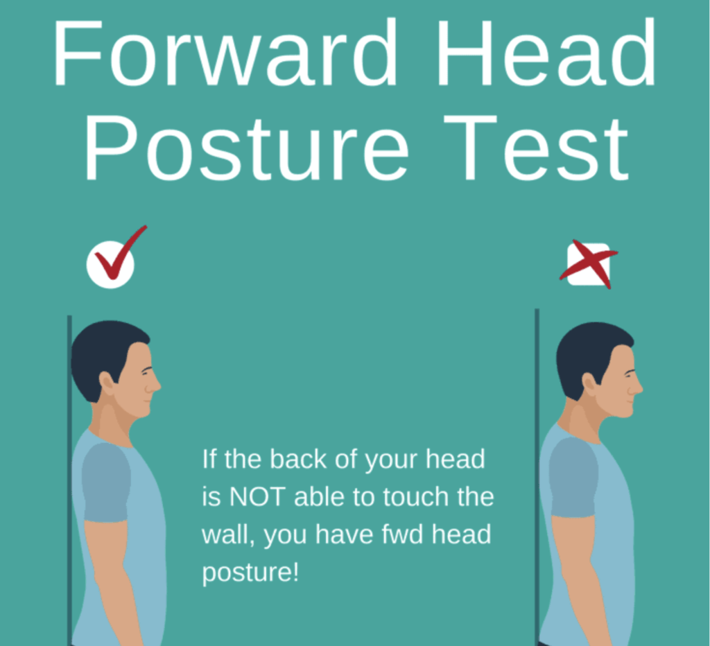 Types of postural defects. Bad posture names