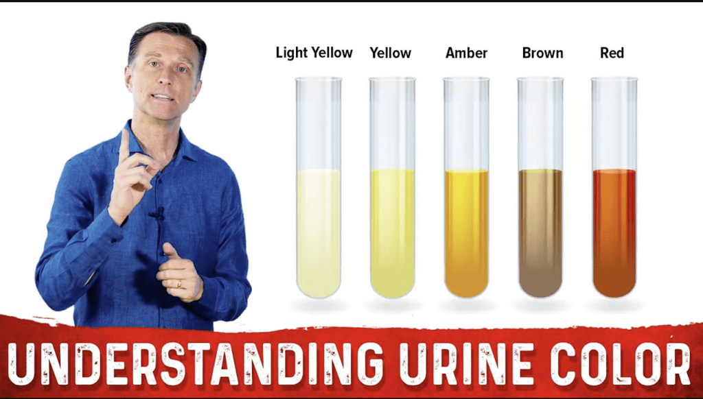 Urine colors