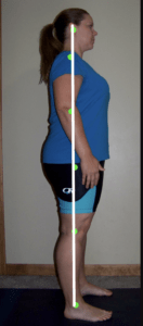 Types of postural defects. Bad posture names